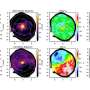 MUSE maps spiral galaxy W2246f, uncovering old core and ongoing star formation across disk